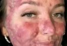 Her body was itchy, he thought it was an allergy