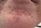 These are the consequences of sleeping with the…See more
