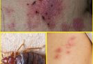 BE CAREFUL, If you spot these dots on your skin, it means…
